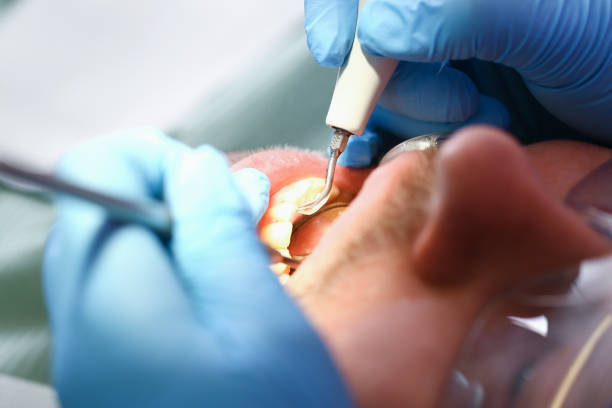 Best Emergency Gum Pain Relief  in Haysville, KS